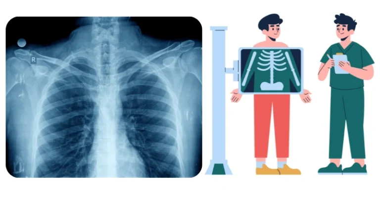 X-Ray Diagnose