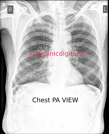 X-ray Image