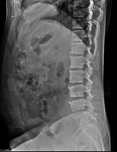 X-ray Image